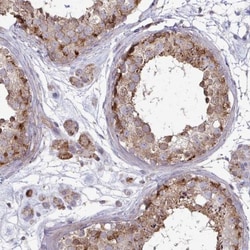 SPRY1 Antibody, Novus Biologicals 25 &mu;L, Unlabeled:Antibodies, Polyclonal